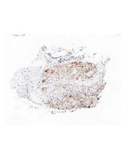 TRPA1 Rabbit anti-Human, Mouse, Rat, Polyclonal, Novus Biologicals 100